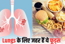 Photo of आपके खानपान की आदतें बढ़ा सकती हैं Lung Cancer का खतरा