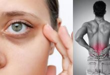 Photo of शरीर में दिखें ये 7 लक्षण तो समझ जाएं कम हो गया है Collagen