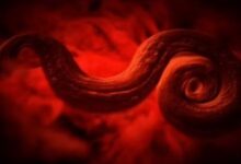 Photo of जानलेवा हो सकते हैं शरीर में छिपे 5 Parasites