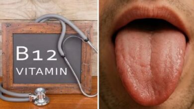 Photo of जीभ पर दिखते हैं विटामिन-B12 की कमी के 3 बड़े संकेत