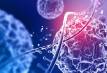 Photo of महिलाओं से ज्यादा पुरुष हो रहे हैं कैंसर का शिकार