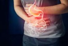 Photo of लूज मोशन में कैसा होना चाहिए खानपान? 