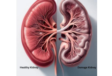 Photo of दोनों किडनी खराब होने के क्या संकेत हैं? जानिए Kidney Failure के शुरुआती लक्षण और बचाव के जरूरी उपाय